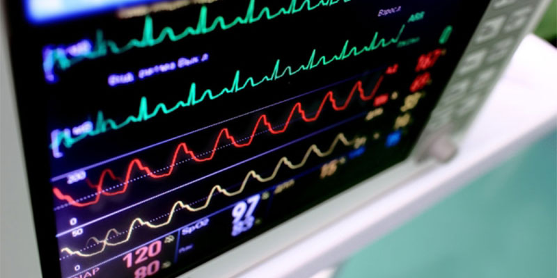 اهمیت ماژول ECG در دستگاههای مانیتورینگ