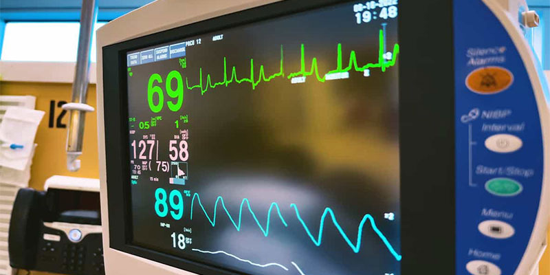 اهمیت ماژول ECG در دستگاههای مانیتورینگ