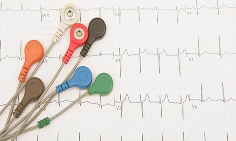 چرا کیفیت کابل ECG در دقت نوار قلب اهمیت دارد؟
