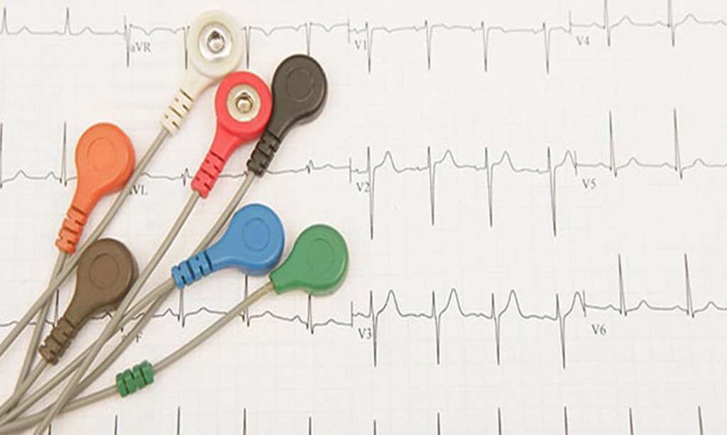 چرا کیفیت کابل ECG در دقت نوار قلب اهمیت دارد؟